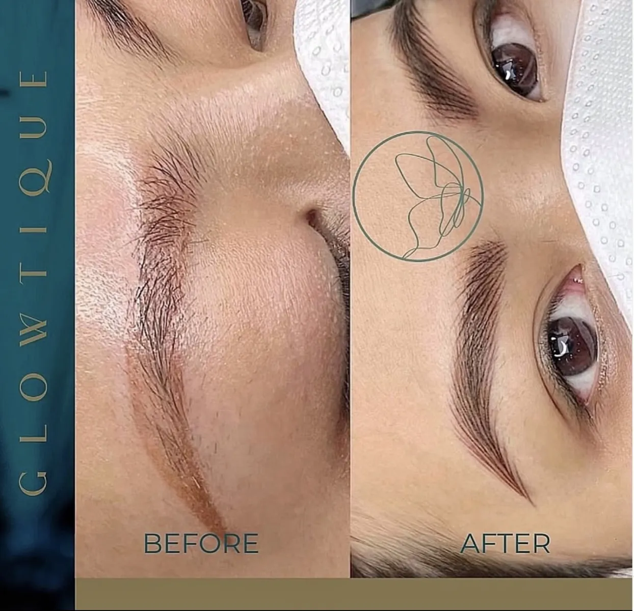 Brow Correction before and after at Glowtique Brisbane