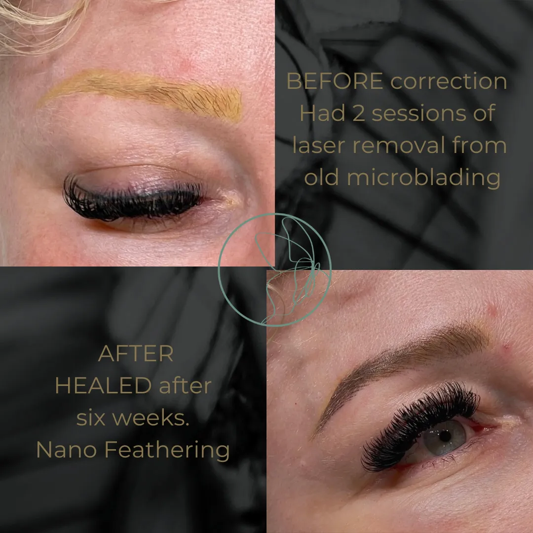 Brow correction transformation at Glowtique