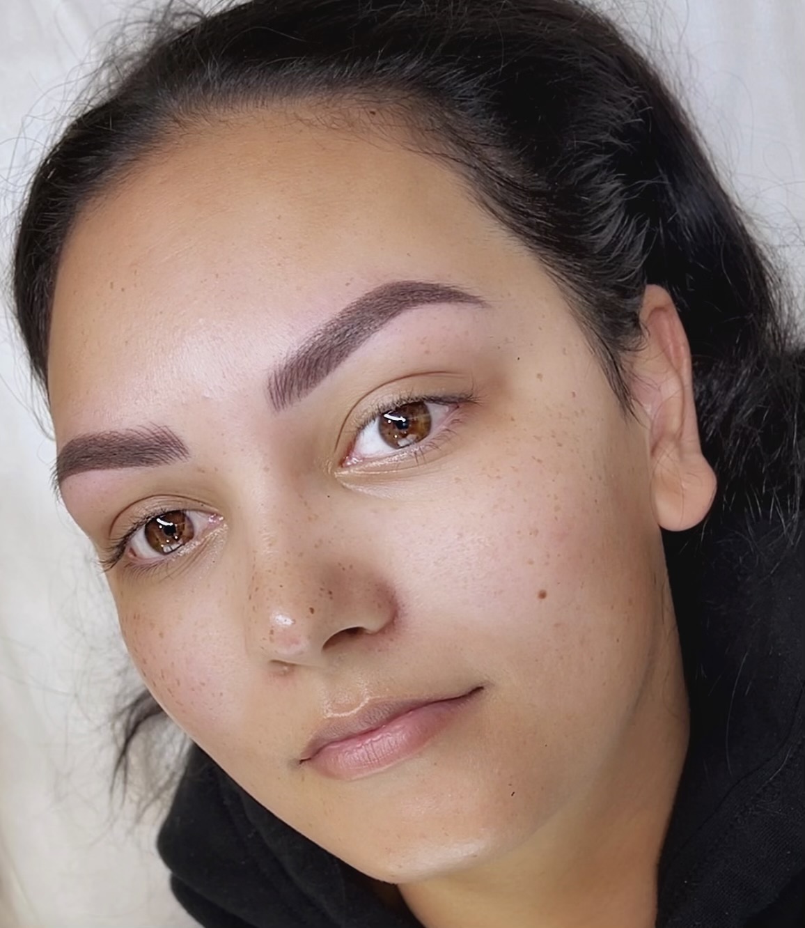 Combination before and after at Glowtique Brisbane
