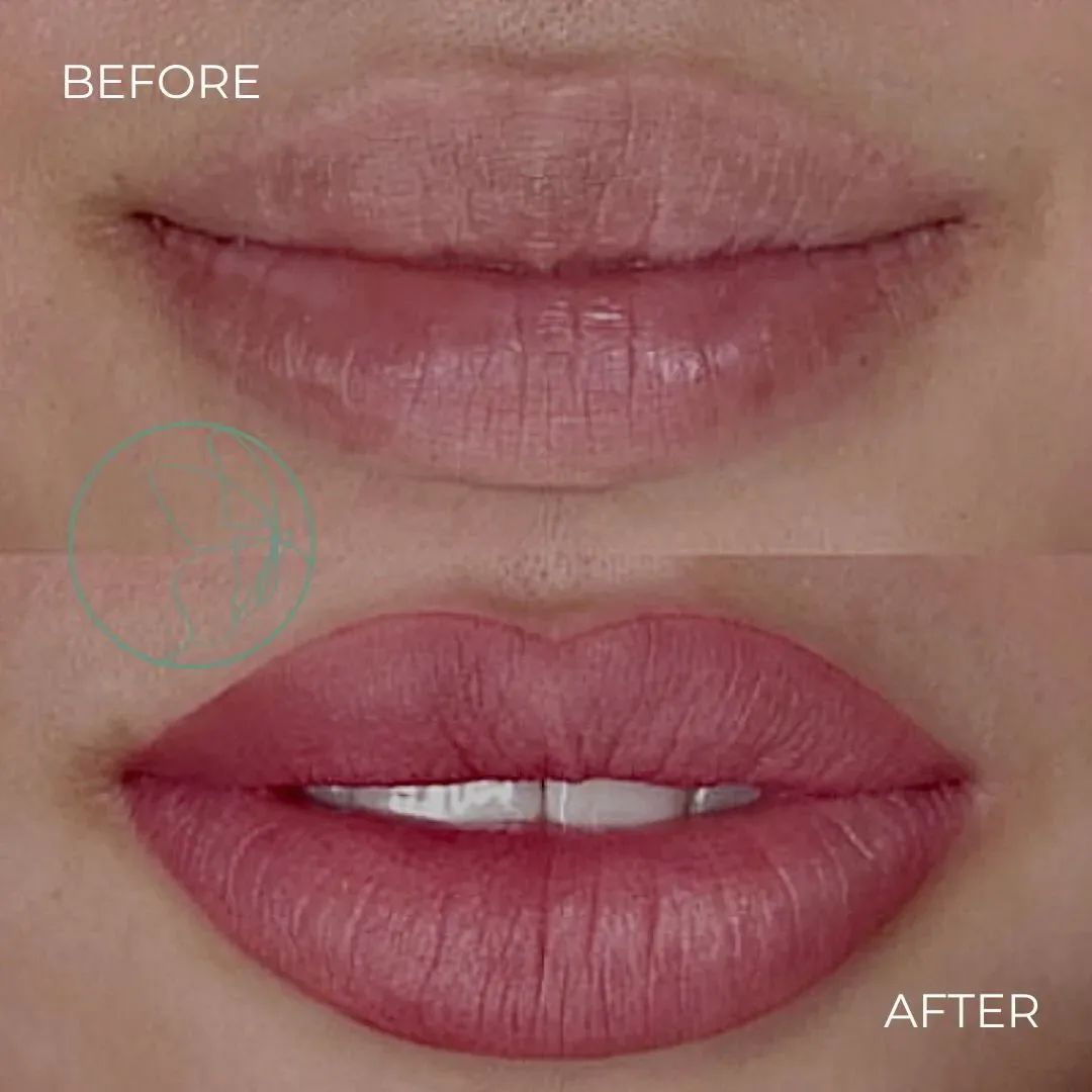 Lip Blush before and after at Glowtique Brisbane
