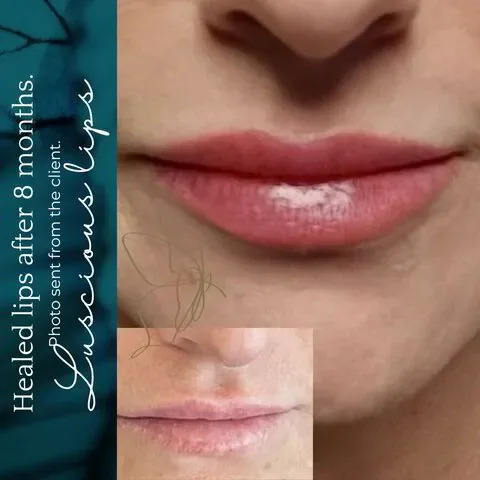 Lip Blush before and after at Glowtique Brisbane