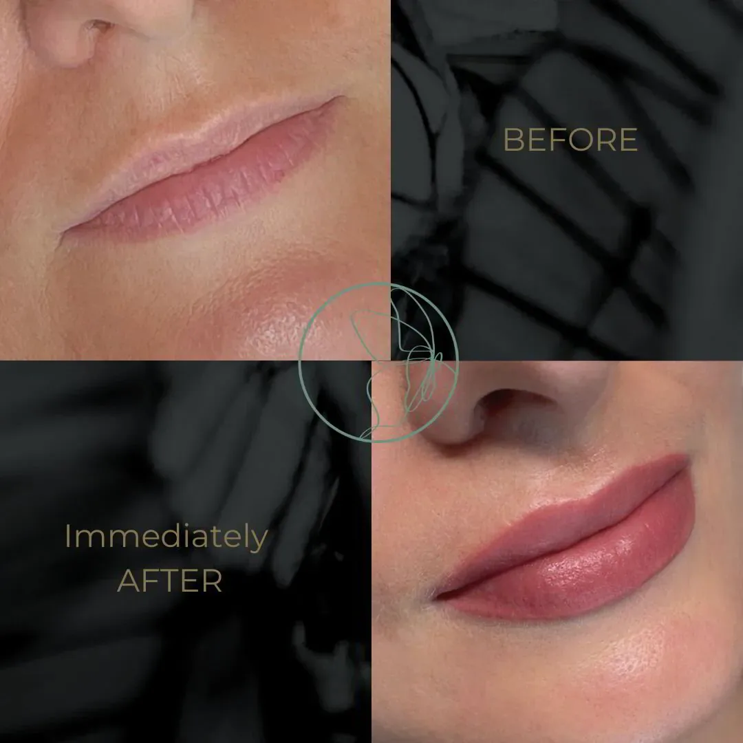 Lip Blush before and after at Glowtique Brisbane