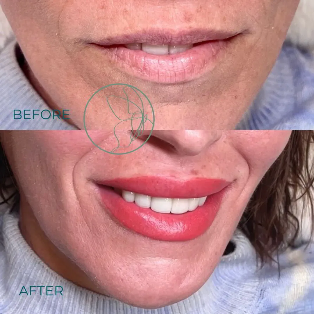 Lip Blush before and after at Glowtique Brisbane