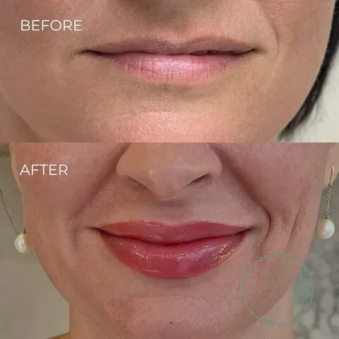 Lip Blush before and after at Glowtique Brisbane