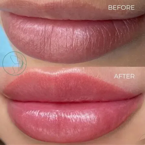 Lip Blush before and after at Glowtique Brisbane