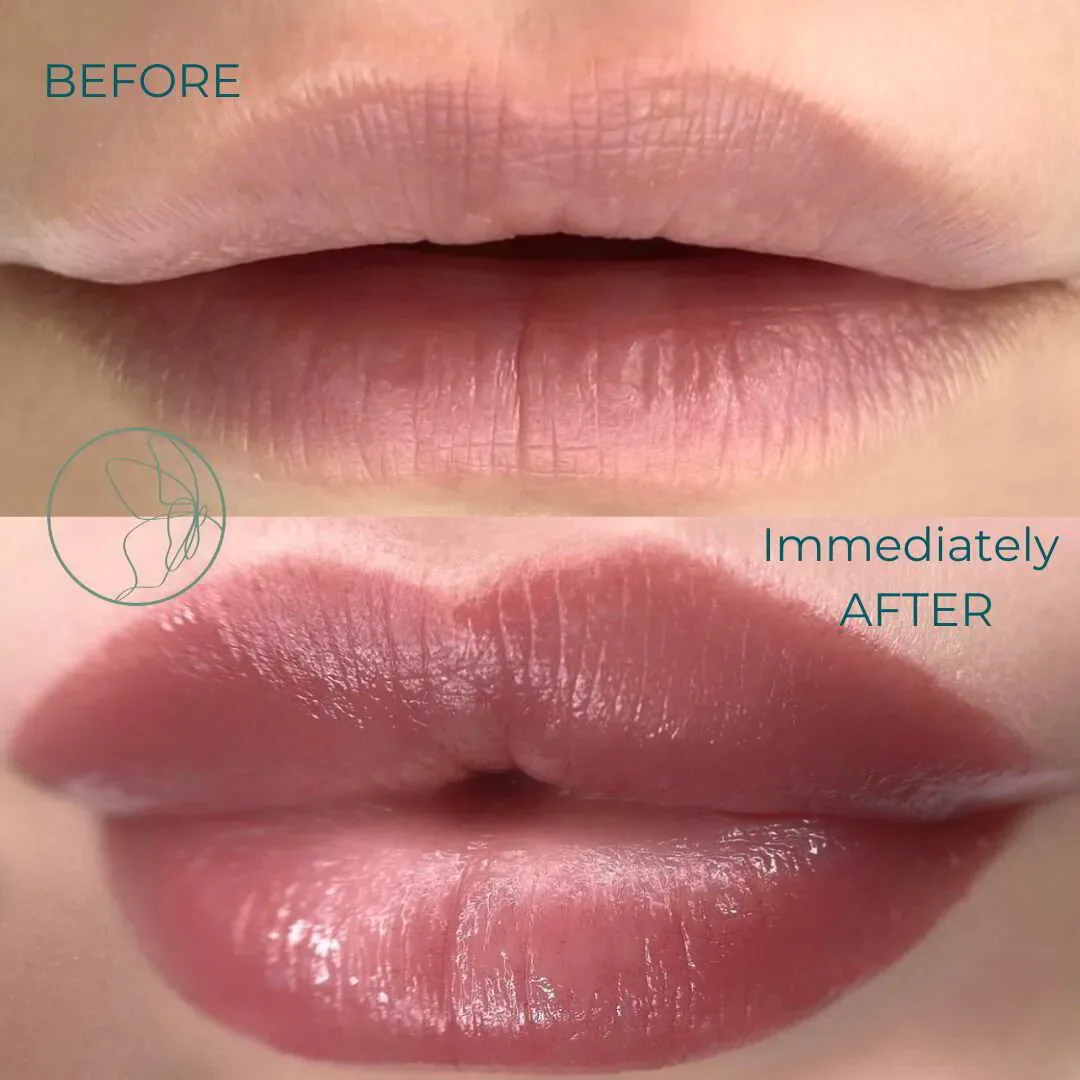 Lip Blush before and after at Glowtique Brisbane
