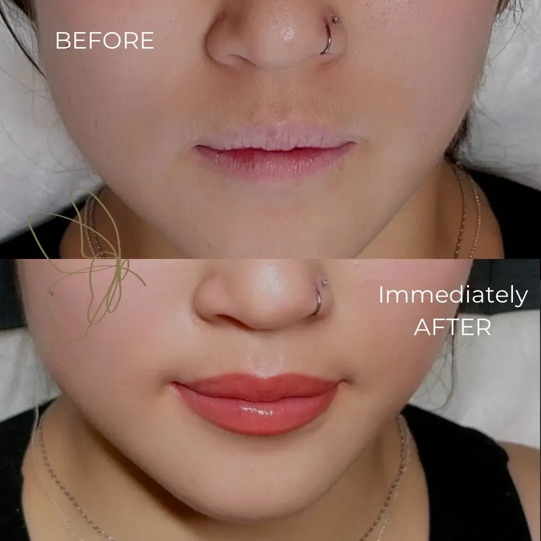 Lip Blush before and after at Glowtique Brisbane