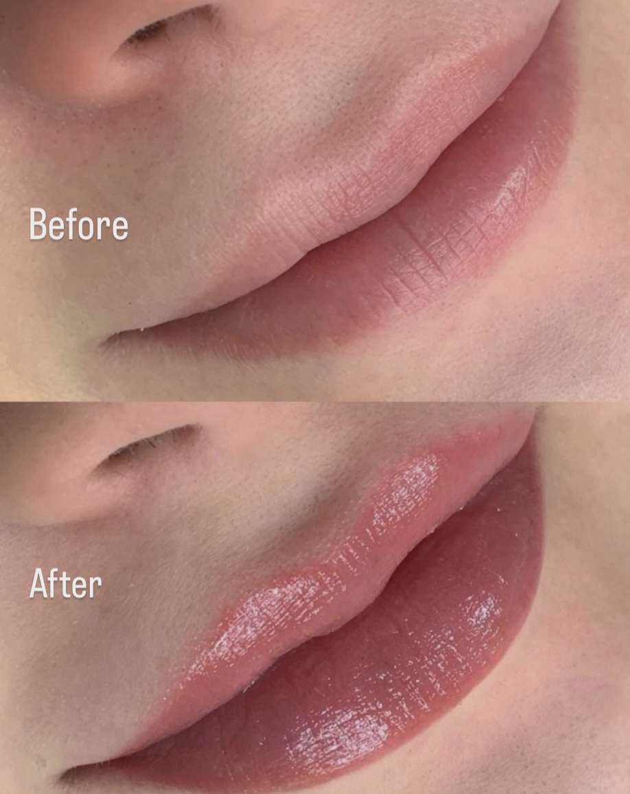 Lip Blush before and after at Glowtique Brisbane