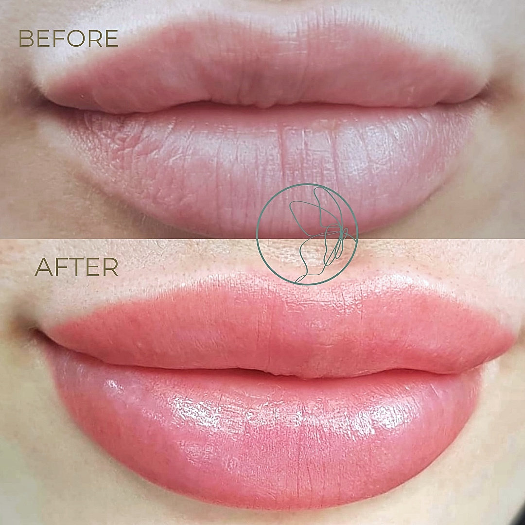 Lip Blush before and after at Glowtique Brisbane