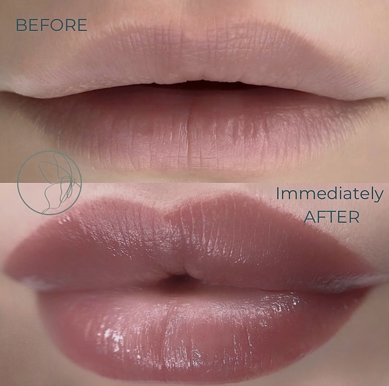 Lip Blush before and after at Glowtique Brisbane