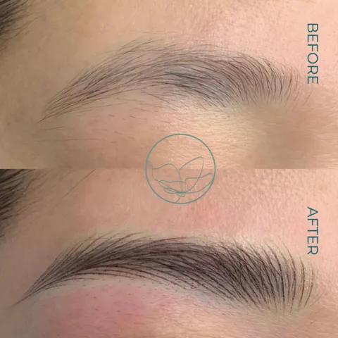 Nano feathering brow transformation at Glowtique