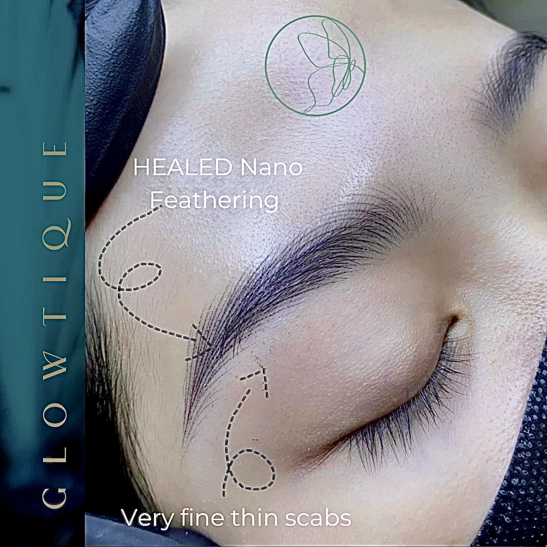 Nano Feathering before and after at Glowtique Brisbane