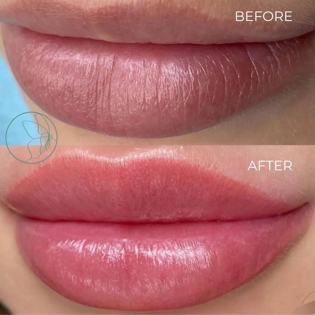 Lip blush transformation at Glowtique